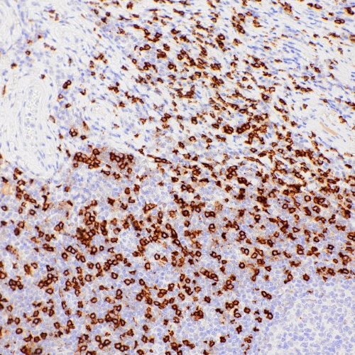 CD8 Mouse Monoclonal Antibody(ARM961)