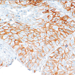 CD99 Rabbit Monoclonal Antibody(ARM962)