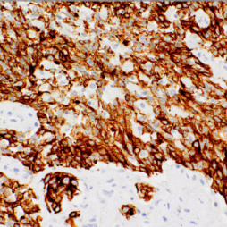 CK(AE1) Mouse Monoclonal Antibody(ARM964)