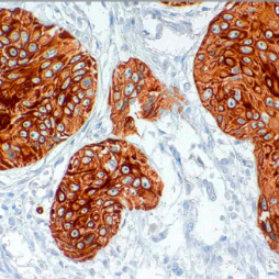 CK(AE3) Mouse Monoclonal Antibody(ARM965)