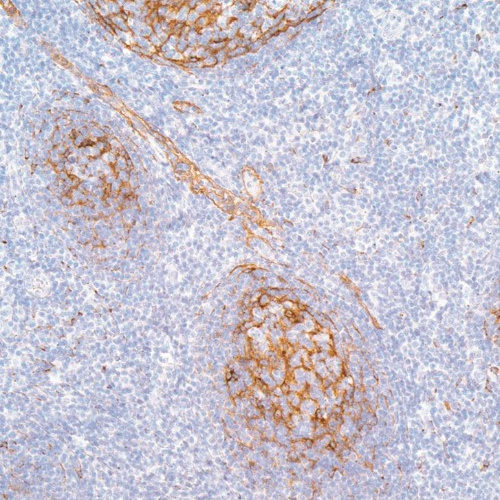 Clusterin/Apolipoprotein J Rabbit Monoclonal Antibody(ARM966)