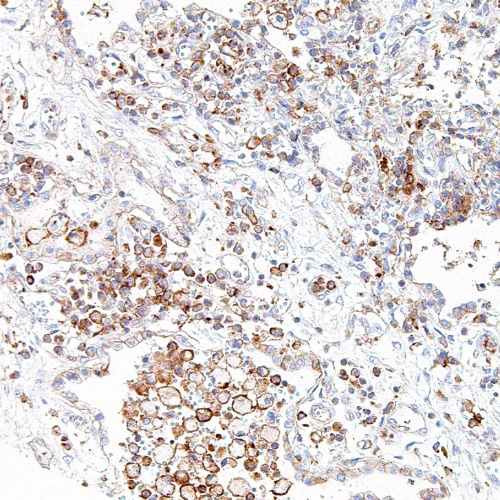 CMTM6 Mouse Monoclonal Antibody(ARM967)