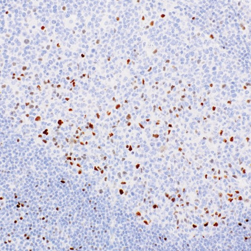c-Myc Rabbit Monoclonal Antibody(ARM968)