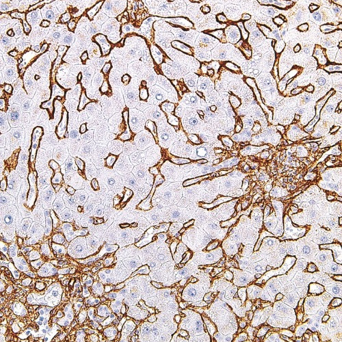 Collagen Type IV Mouse Monoclonal Antibody(ARM969)