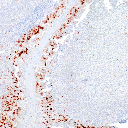 Cyclin D1 Rabbit Monoclonal Antibody(ARM972)