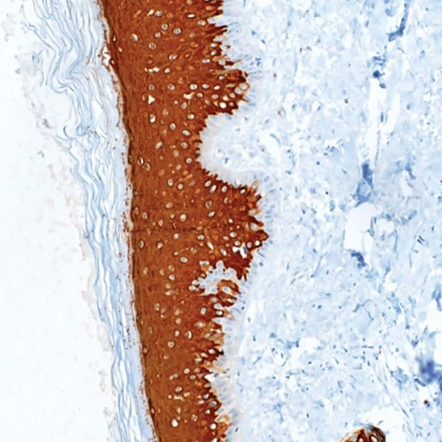 Cytokeratin 10 Rabbit Monoclonal Antibody(ARM973)