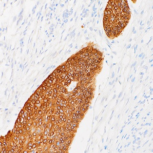 Cytokeratin 14 Mouse Monoclonal Antibody(ARM974)