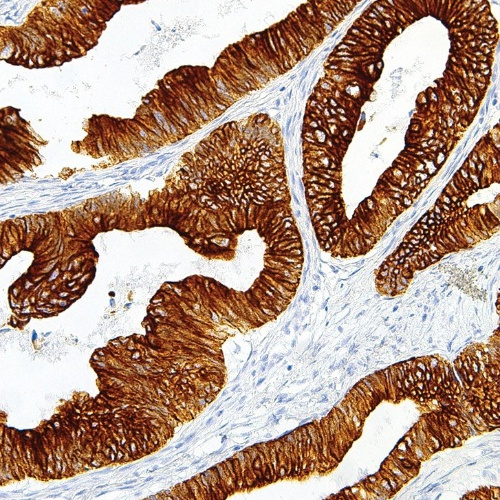 Cytokeratin 18 Mouse Monoclonal Antibody(ARM975)