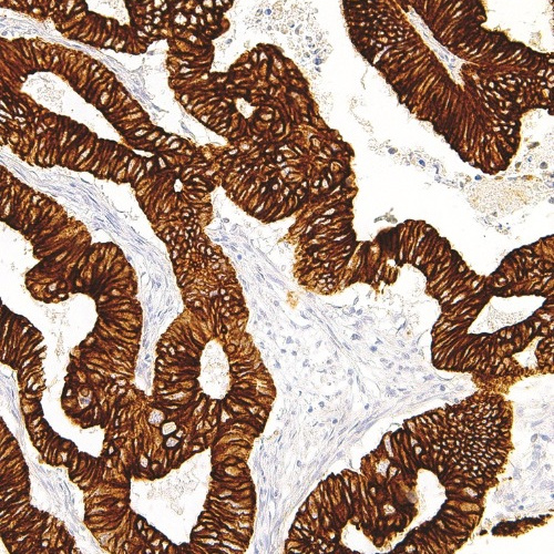 Cytokeratin 19 Mouse Monoclonal Antibody(ARM976)