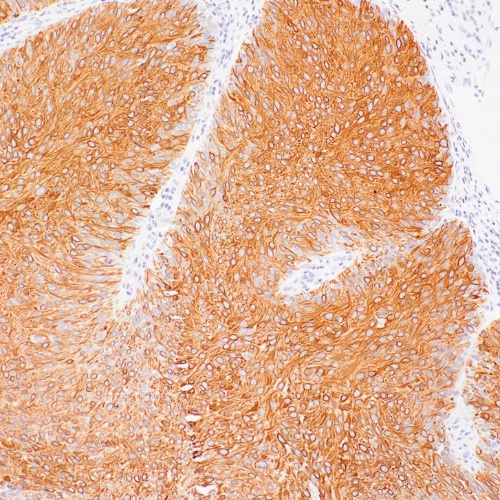 Cytokeratin 20 Rabbit Monoclonal Antibody(ARM977)