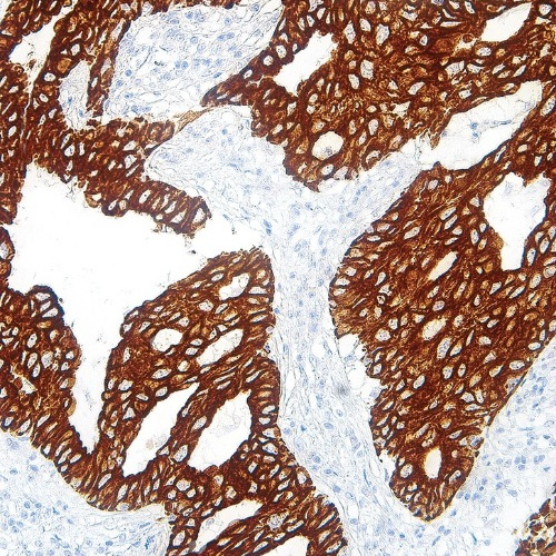 Cytokeratin 7 Mouse Monoclonal Antibody(ARM978)