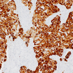 Cytokeratin 7/8 Mouse Monoclonal Antibody(ARM979)