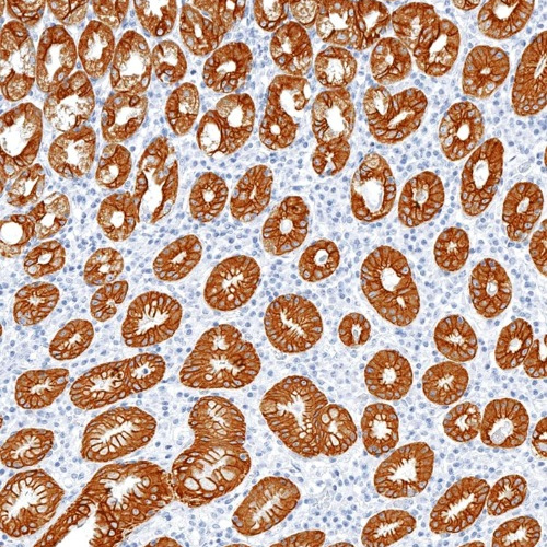 Cytokeratin 8 Rabbit Monoclonal Antibody(ARM980)