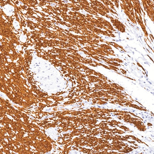 Desmin Mouse Monoclonal Antibody(ARM981)