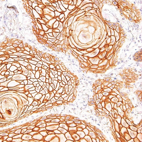 Desmoglein-3 Mouse Monoclonal Antibody(ARM982)