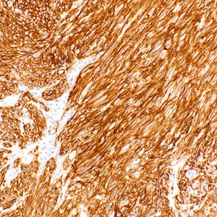 DOG1 Rabbit Monoclonal Antibody(ARM983)
