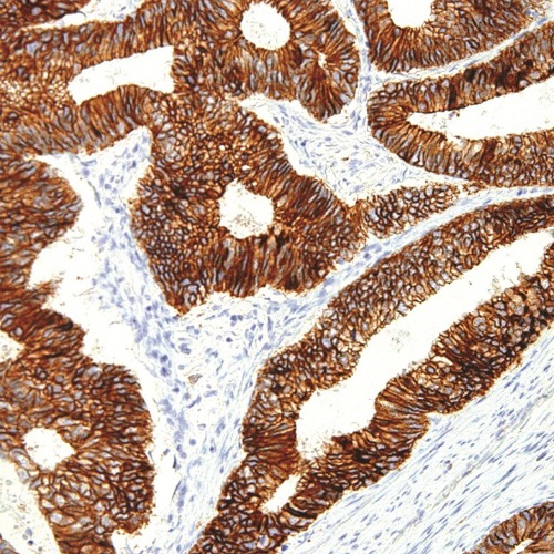 E-Cadherin Mouse Monoclonal Antibody(ARM984)