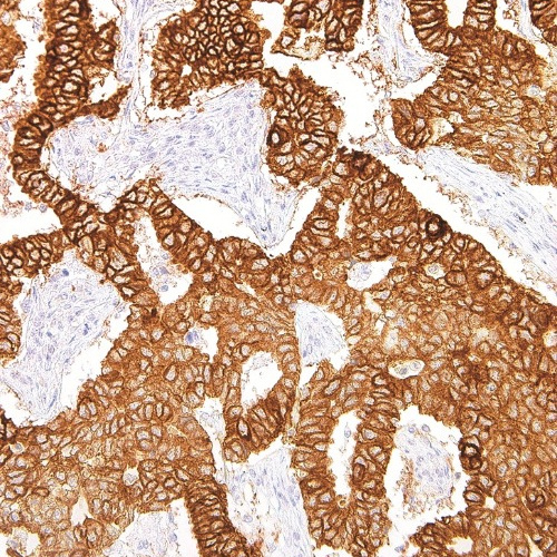 EGFR Mouse Monoclonal Antibody(ARM985)
