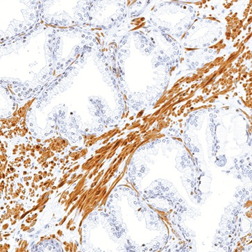 ERG Rabbit Monoclonal Antibody(ARM987)
