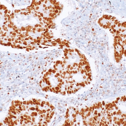 EZH2 Rabbit Monoclonal Antibody(ARM988)