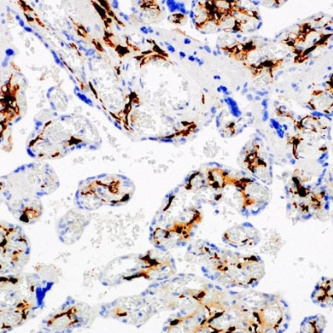 Factor XIIIa Rabbit Monoclonal Antibody(ARM989)
