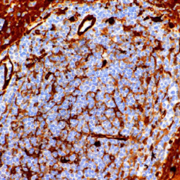 Fascin Mouse Monoclonal Antibody(ARM990)