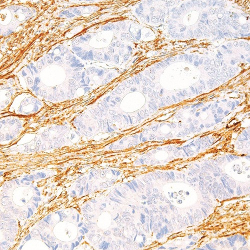 Fibronectin Mouse Monoclonal Antibody(ARM991)