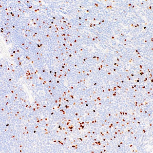 FOXP3 Mouse Monoclonal Antibody(ARM992)