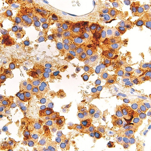 FSH Mouse Monoclonal Antibody(ARM993)
