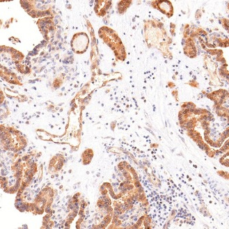 Galectin-3 Mouse Monoclonal Antibody(ARM994)