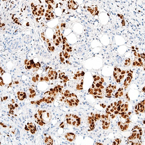 GATA3 Mouse Monoclonal Antibody(ARM995)