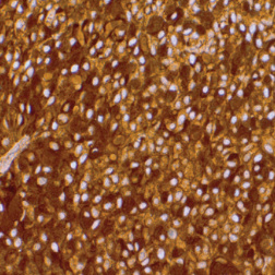 GCDFP-15 Rabbit Monoclonal Antibody(ARM996)