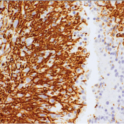 Glial Fibrillary Acidic Protein (GFAP) Rabbit Monoclonal Antibody(ARM997)