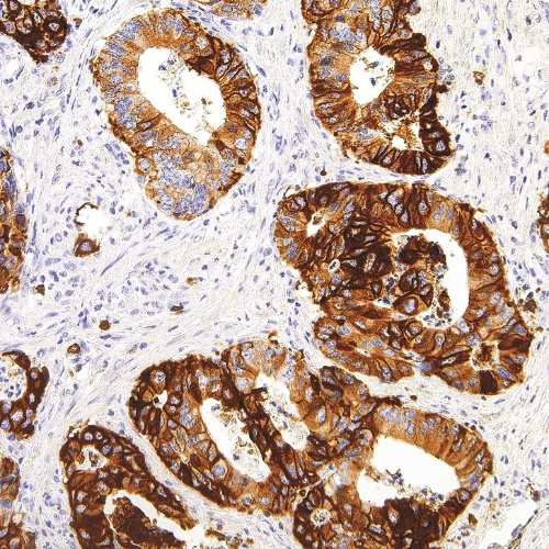 GLUT1 Mouse Monoclonal Antibody(ARM998)