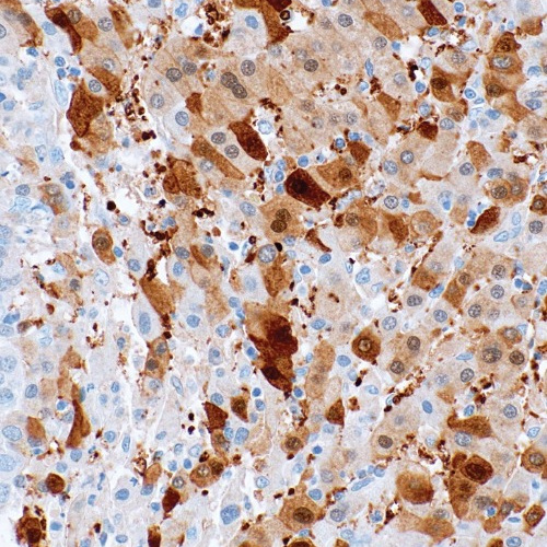 Glypican-3 Mouse Monoclonal Antibody(ARM500)