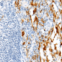 Granzyme B Mouse Monoclonal Antibody(ARM501)