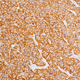 Growth Hormone (GH) Mouse Monoclonal Antibody(ARM502)