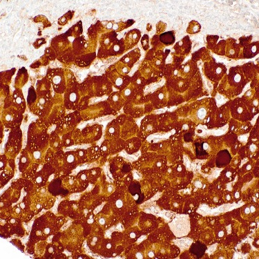 HBsAg Mouse Monoclonal Antibody(ARM504)