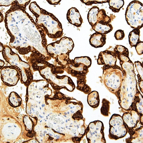 hCG Mouse Monoclonal Antibody(ARM505)