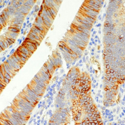 hENT1 Rabbit Monoclonal Antibody(ARM506)