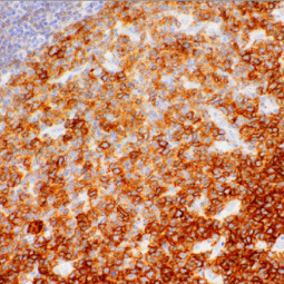HGAL Mouse Monoclonal Antibody(ARM507)