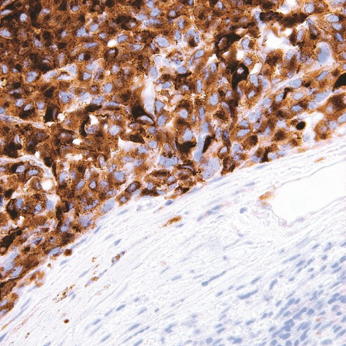 HMB-45 Mouse Monoclonal Antibody(ARM509)