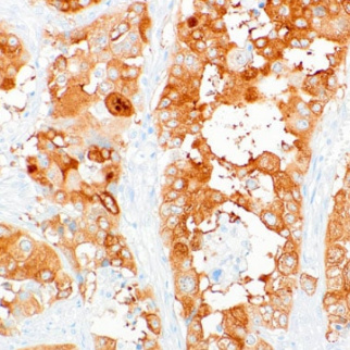 IMP3 Rabbit Monoclonal Antibody(ARM510)
