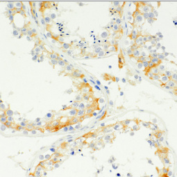 Inhibin Alpha Mouse Monoclonal Antibody(ARM511)