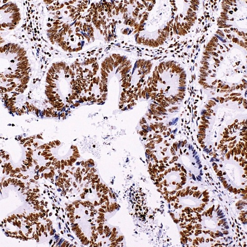 INI-1 Mouse Monoclonal Antibody(ARM512)