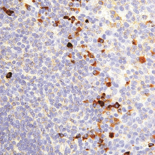Kappa Mouse Monoclonal Antibody(ARM514)
