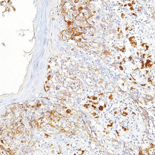 KBA.62 (Melanoma Associated Antigen) Mouse Monoclonal Antibody(ARM515)