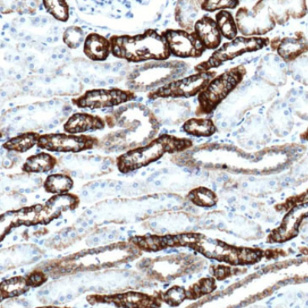 Ksp-cadherin Rabbit Monoclonal Antibody(ARM516)