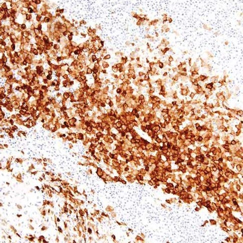 Langerin Mouse Monoclonal Antibody(ARM518)
