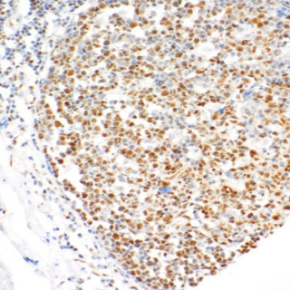 LMO2 Rabbit Monoclonal Antibody(ARM519)